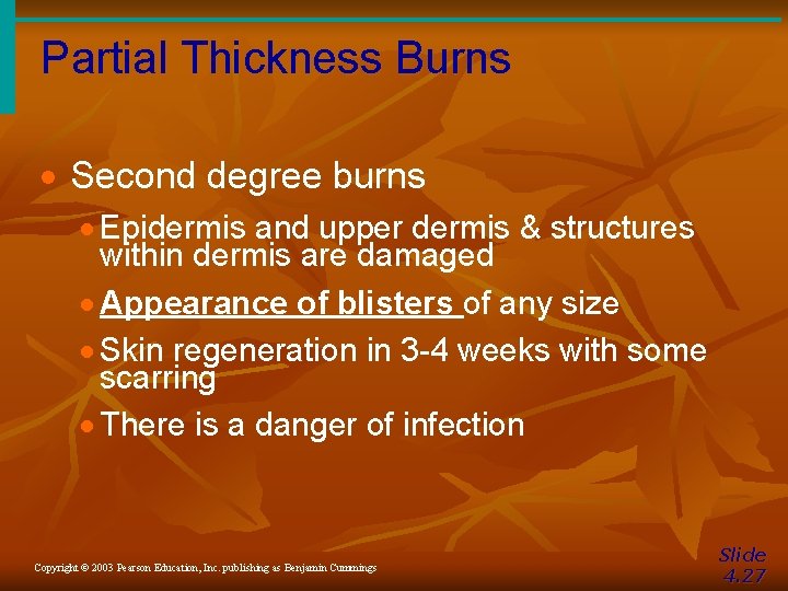Partial Thickness Burns · Second degree burns · Epidermis and upper dermis & structures Partial Thickness Burns · Second degree burns · Epidermis and upper dermis & structures