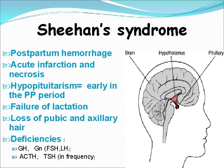 Sheehan’s syndrome Postpartum hemorrhage Acute infarction and necrosis Hypopituitarism= early in the PP period