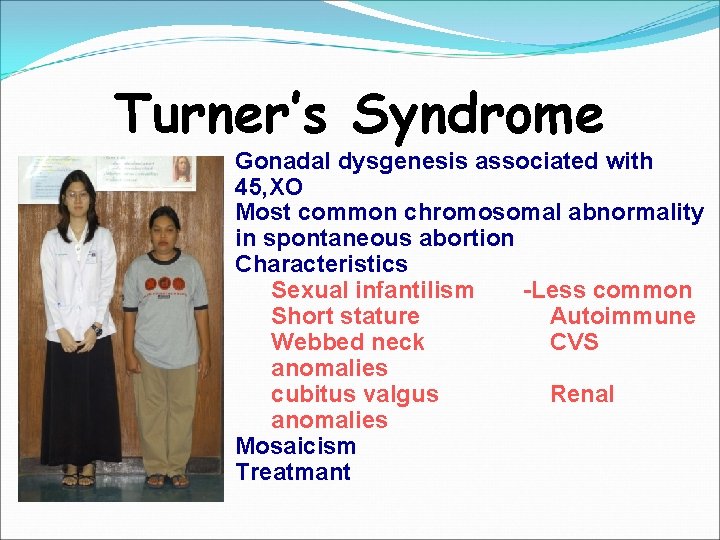 Turner’s Syndrome Gonadal dysgenesis associated with 45, XO Most common chromosomal abnormality in spontaneous