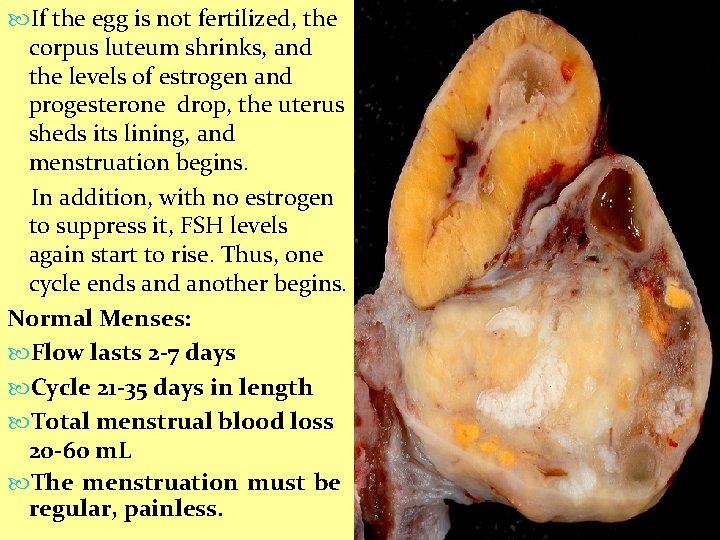  If the egg is not fertilized, the corpus luteum shrinks, and the levels