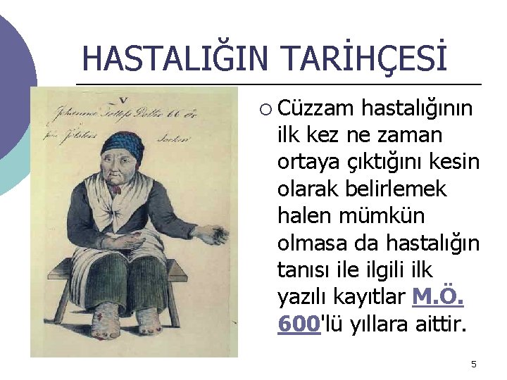 HASTALIĞIN TARİHÇESİ ¡ Cüzzam hastalığının ilk kez ne zaman ortaya çıktığını kesin olarak belirlemek