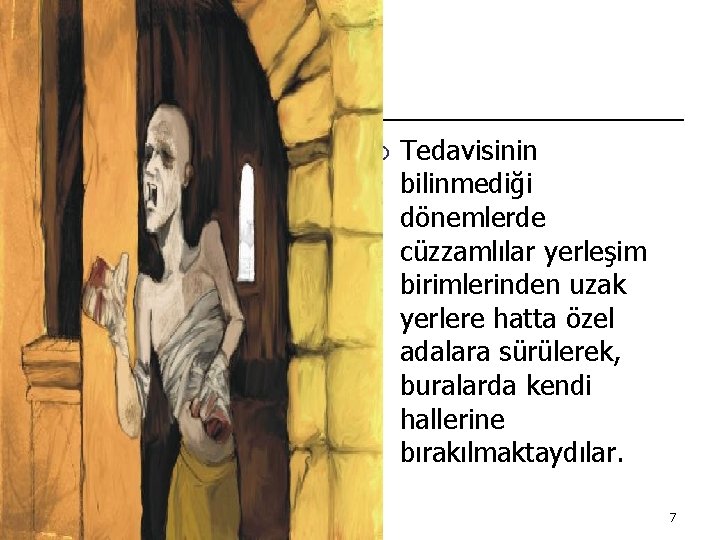 ¡ Tedavisinin bilinmediği dönemlerde cüzzamlılar yerleşim birimlerinden uzak yerlere hatta özel adalara sürülerek, buralarda