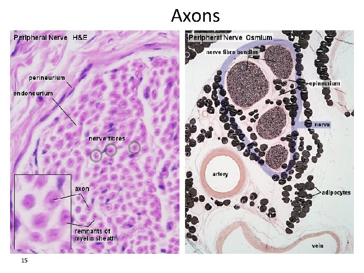 Axons 15 