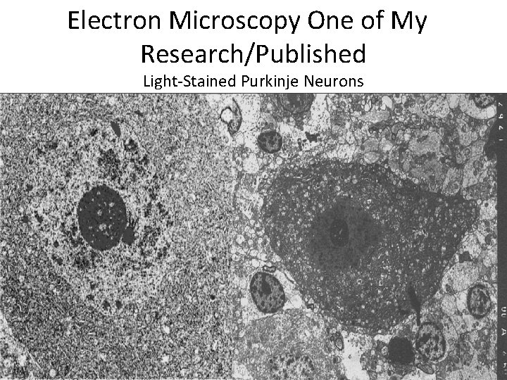 Electron Microscopy One of My Research/Published Light-Stained Purkinje Neurons 