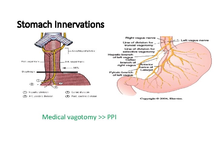 Stomach Innervations Medical vagotomy >> PPI 