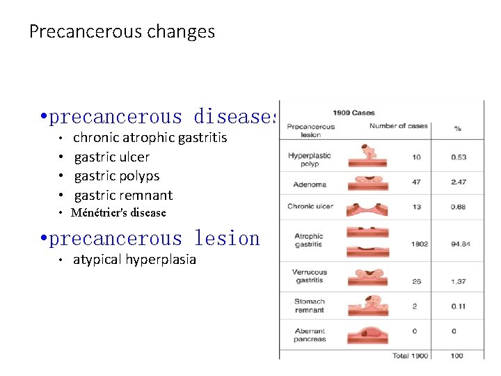 Precancerous changes • precancerous diseases • chronic atrophic gastritis • gastric ulcer • gastric