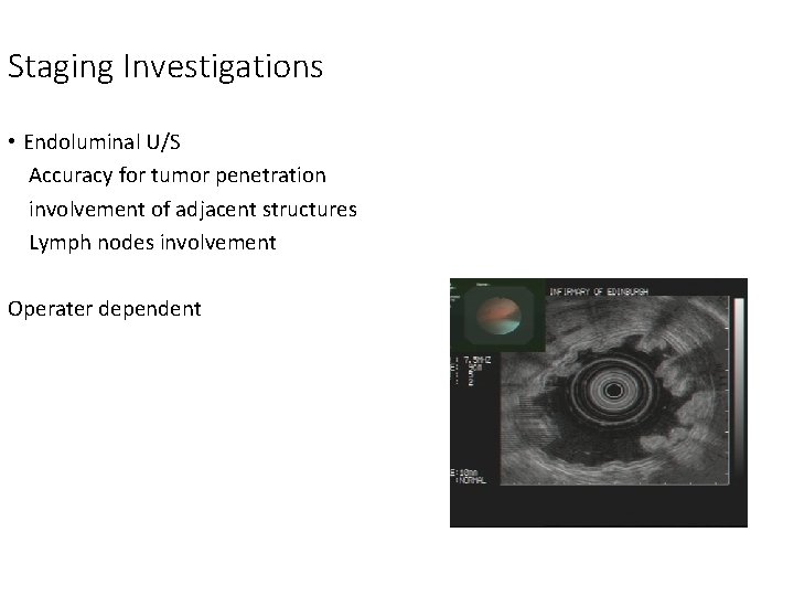 Staging Investigations • Endoluminal U/S Accuracy for tumor penetration involvement of adjacent structures Lymph