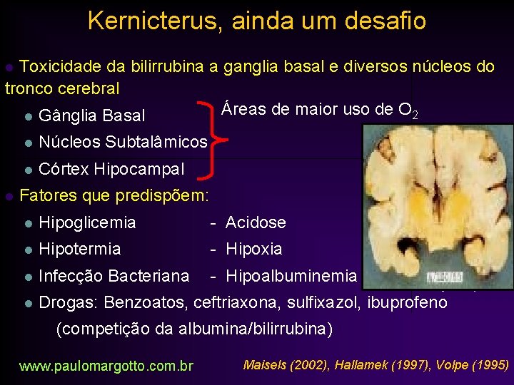 Kernicterus, ainda um desafio Toxicidade da bilirrubina a ganglia basal e diversos núcleos do