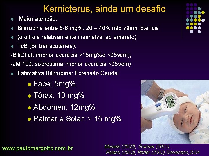 Kernicterus, ainda um desafio l Maior atenção: l Bilirrubina entre 6 -8 mg%: 20