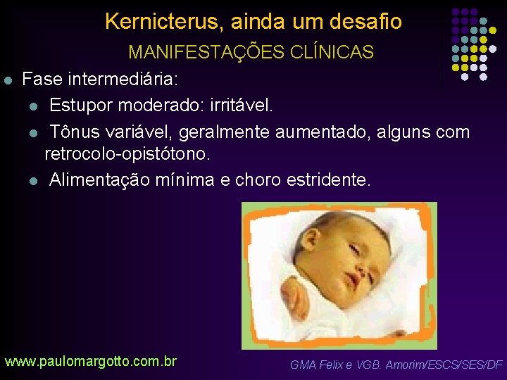 Kernicterus, ainda um desafio l MANIFESTAÇÕES CLÍNICAS Fase intermediária: l Estupor moderado: irritável. l