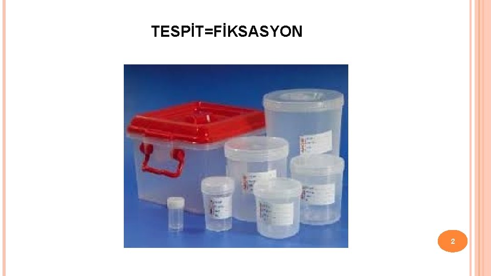 TESPİT=FİKSASYON 2 