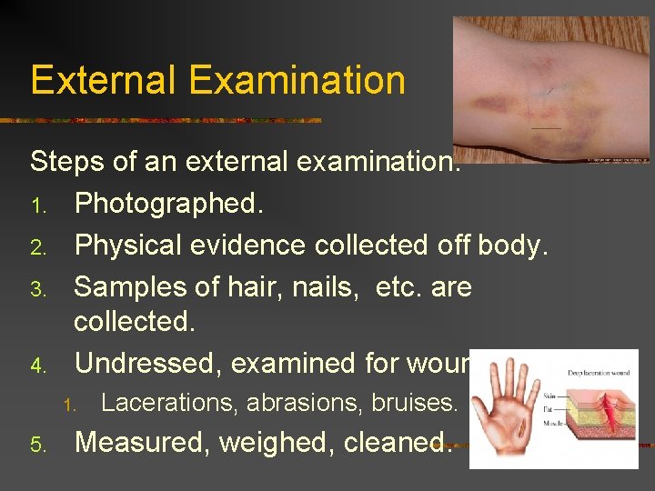 External Examination Steps of an external examination. 1. Photographed. 2. Physical evidence collected off