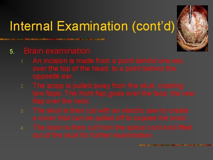 Internal Examination (cont’d) 5. Brain examination 1. 2. 3. 4. An incision is made