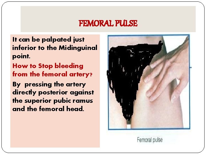 Femoral Artery A Femoralis The Arteries Of The Lower Femoral Artery A Femoralis The Arteries Of The Lower