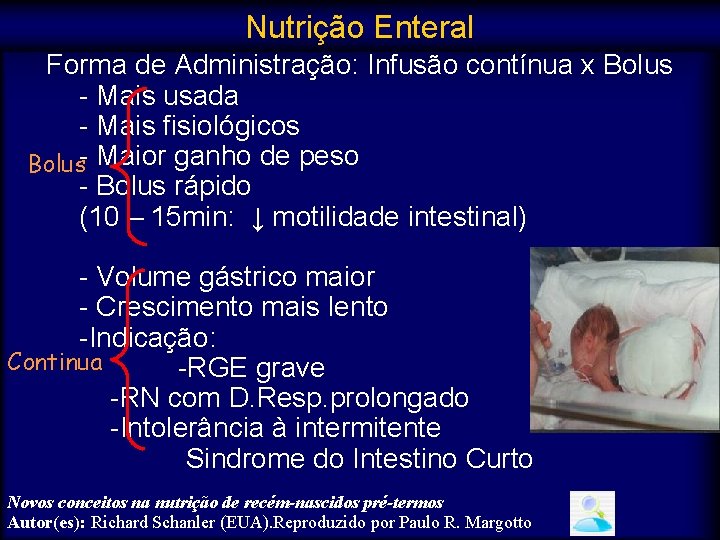 Nutrição Enteral Forma de Administração: Infusão contínua x Bolus - Mais usada - Mais