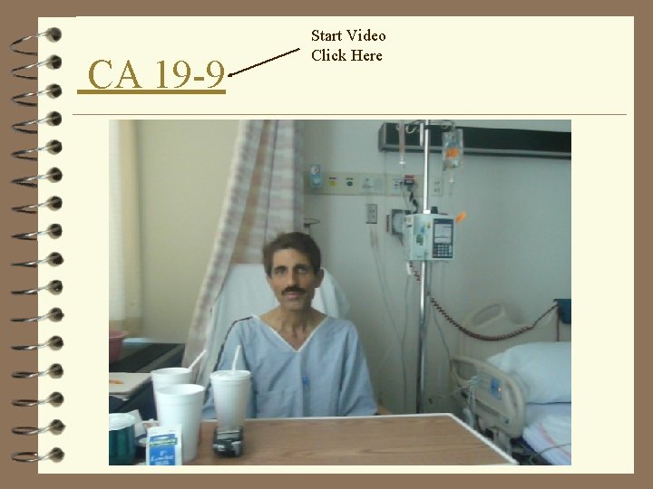 CA 19 -9 Start Video Click Here 