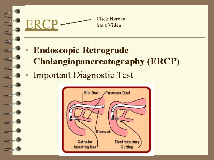 ERCP Click Here to Start Video • Endoscopic Retrograde Cholangiopancreatography (ERCP) • Important Diagnostic