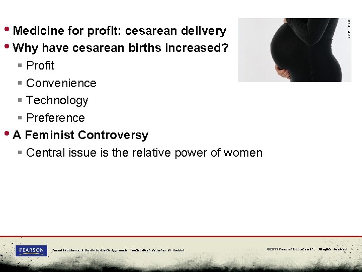  • Medicine for profit: cesarean delivery • Why have cesarean births increased? §