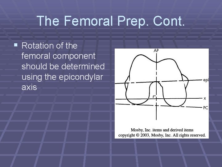The Femoral Prep. Cont. § Rotation of the femoral component should be determined using