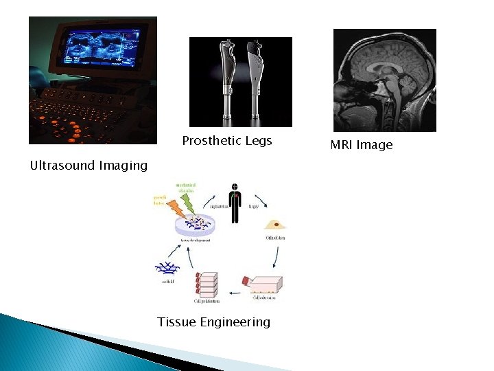 Prosthetic Legs Ultrasound Imaging Tissue Engineering MRI Image 