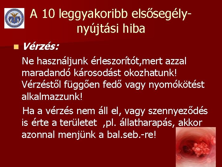 A 10 leggyakoribb elsősegélynyújtási hiba n Vérzés: Ne használjunk érleszorítót, mert azzal maradandó károsodást A 10 leggyakoribb elsősegélynyújtási hiba n Vérzés: Ne használjunk érleszorítót, mert azzal maradandó károsodást