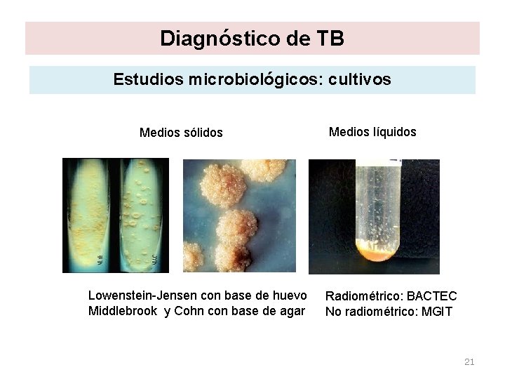 Diagnóstico de TB Estudios microbiológicos: cultivos Medios sólidos Lowenstein-Jensen con base de huevo Middlebrook Diagnóstico de TB Estudios microbiológicos: cultivos Medios sólidos Lowenstein-Jensen con base de huevo Middlebrook