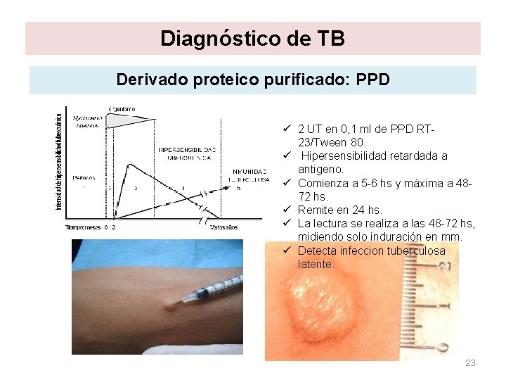Diagnóstico de TB Derivado proteico purificado: PPD ü 2 UT en 0, 1 ml Diagnóstico de TB Derivado proteico purificado: PPD ü 2 UT en 0, 1 ml