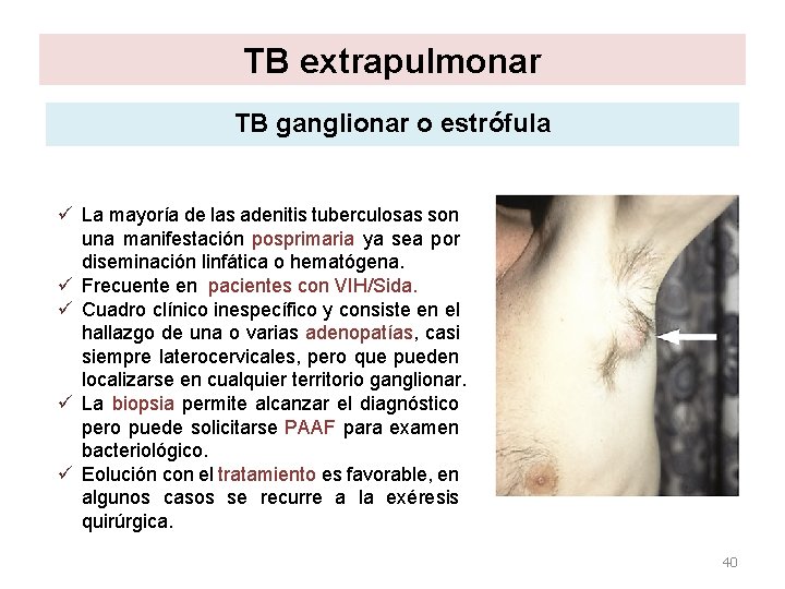 TB extrapulmonar TB ganglionar o estrófula ü La mayoría de las adenitis tuberculosas son TB extrapulmonar TB ganglionar o estrófula ü La mayoría de las adenitis tuberculosas son