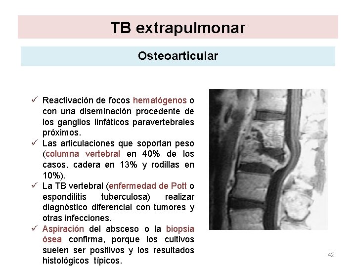 TB extrapulmonar Osteoarticular ü Reactivación de focos hematógenos o con una diseminación procedente de TB extrapulmonar Osteoarticular ü Reactivación de focos hematógenos o con una diseminación procedente de