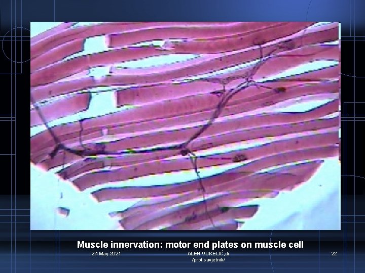 Muscle innervation: motor end plates on muscle cell 24 May 2021 ALEN VUKELIĆ, dr