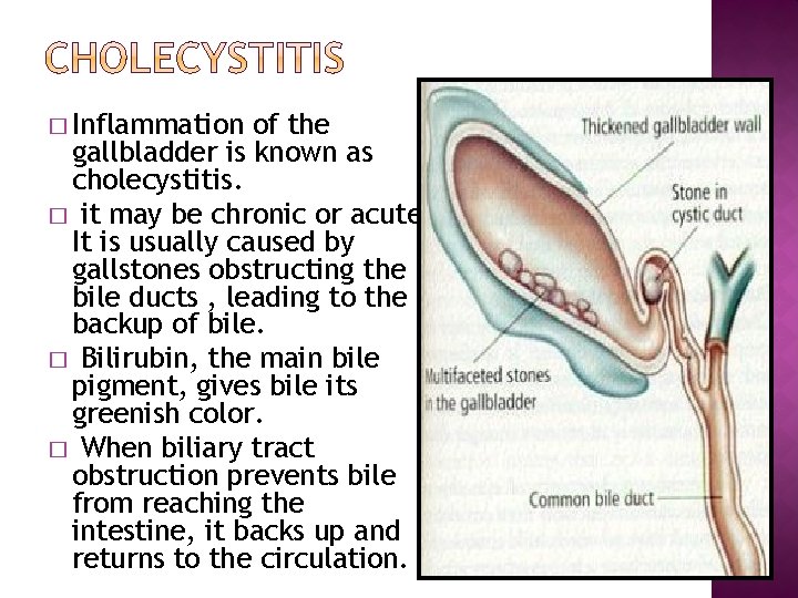 � Inflammation of the gallbladder is known as cholecystitis. � it may be chronic