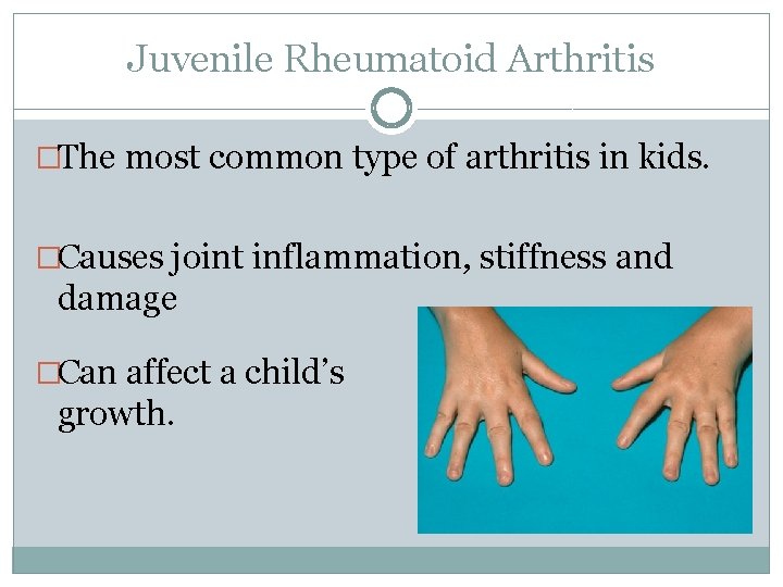 Juvenile Rheumatoid Arthritis �The most common type of arthritis in kids. �Causes joint inflammation,
