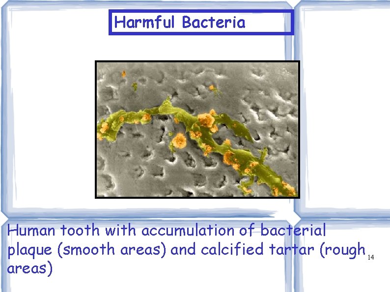 Harmful Bacteria Human tooth with accumulation of bacterial plaque (smooth areas) and calcified tartar