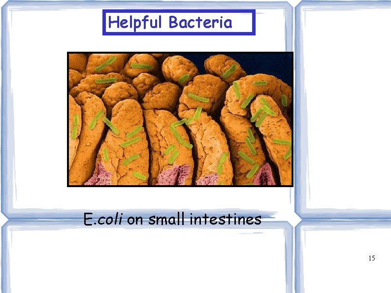 Helpful Bacteria E. coli on small intestines 15 