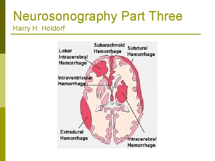 Neurosonography Part Three Harry H. Holdorf 