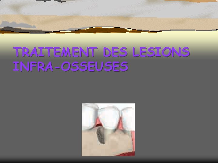 TRAITEMENT DES LESIONS INFRA-OSSEUSES 