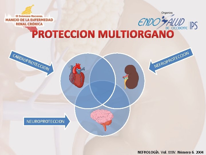 PROTECCION MULTIORGANO CAR D IOP N ROT ECC ION CCIO E T O OPR