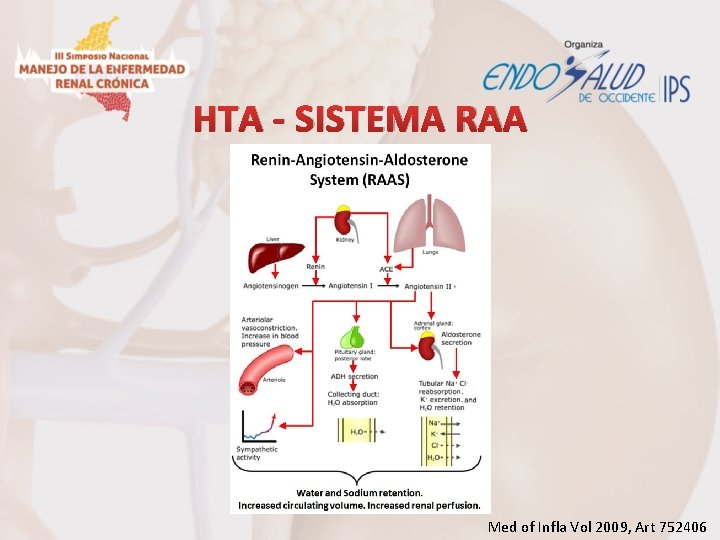HTA - SISTEMA RAA Med of Infla Vol 2009, Art 752406 