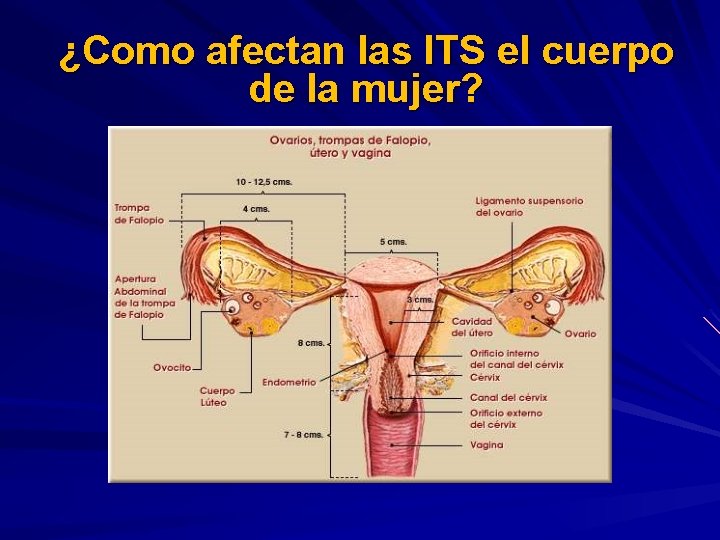 ¿Como afectan las ITS el cuerpo de la mujer? 