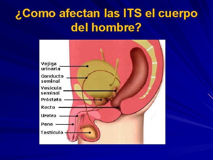 ¿Como afectan las ITS el cuerpo del hombre? 