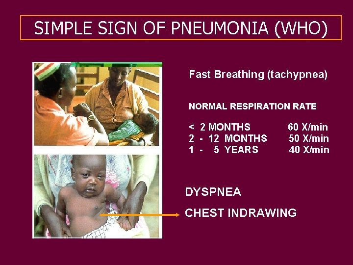 SIMPLE SIGN OF PNEUMONIA (WHO) Fast Breathing (tachypnea) NORMAL RESPIRATION RATE < 2 MONTHS