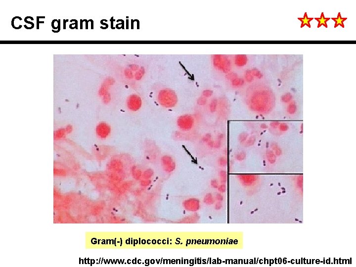 CSF gram stain Gram(-) diplococci: S. pneumoniae http: //www. cdc. gov/meningitis/lab-manual/chpt 06 -culture-id. html