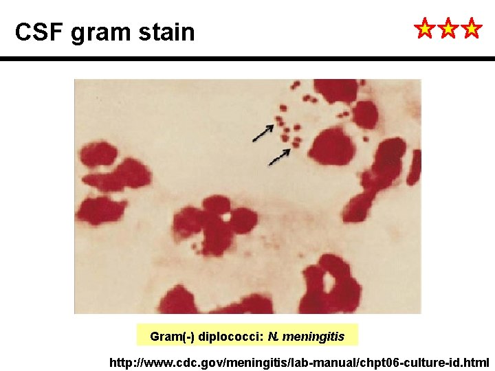 CSF gram stain Gram(-) diplococci: N. meningitis http: //www. cdc. gov/meningitis/lab-manual/chpt 06 -culture-id. html