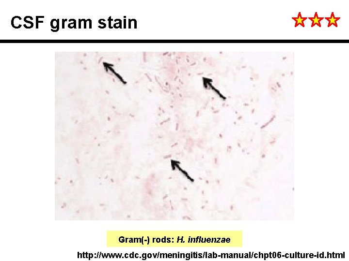 CSF gram stain Gram(-) rods: H. influenzae http: //www. cdc. gov/meningitis/lab-manual/chpt 06 -culture-id. html
