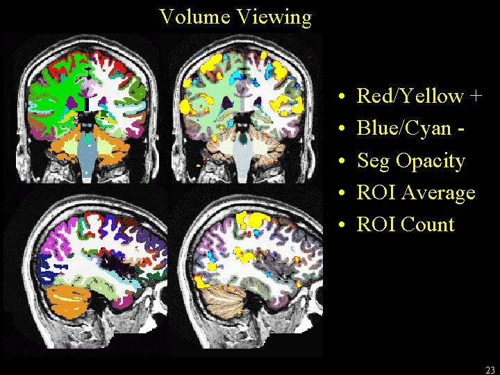 Volume Viewing • • • Red/Yellow + Blue/Cyan Seg Opacity ROI Average ROI Count
