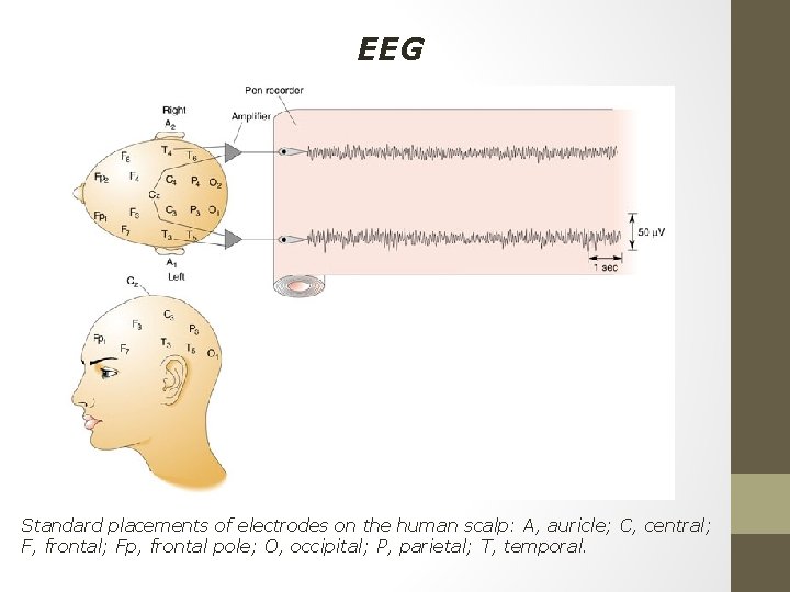 EEG Standard placements of electrodes on the human scalp: A, auricle; C, central; F,