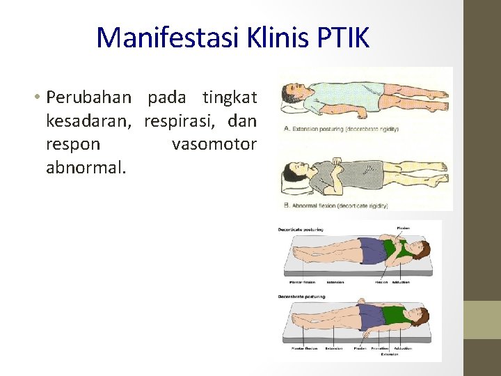 Manifestasi Klinis PTIK • Perubahan pada tingkat kesadaran, respirasi, dan respon vasomotor abnormal. 