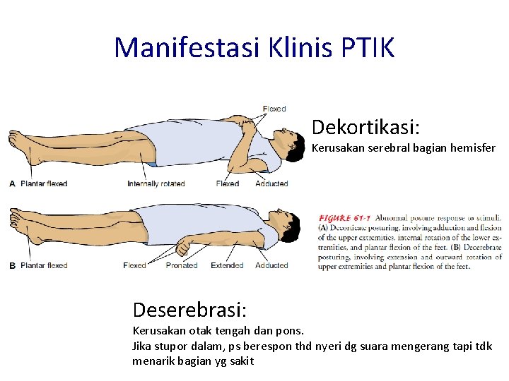 Manifestasi Klinis PTIK Dekortikasi: Kerusakan serebral bagian hemisfer Deserebrasi: Kerusakan otak tengah dan pons.