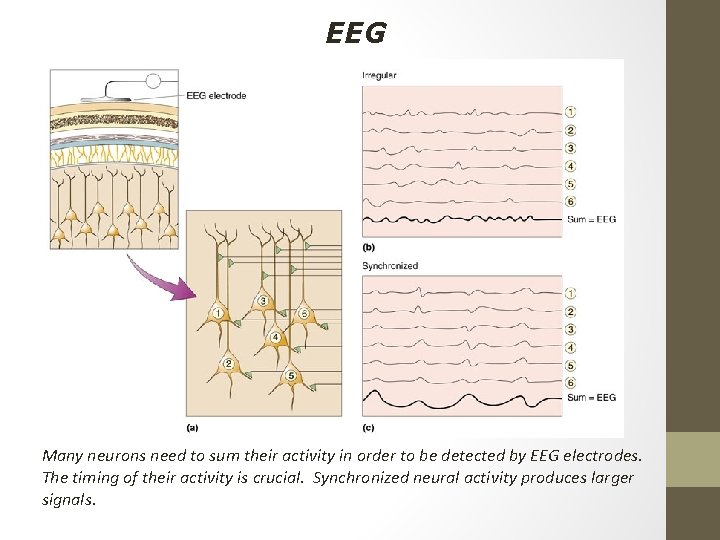 EEG Many neurons need to sum their activity in order to be detected by