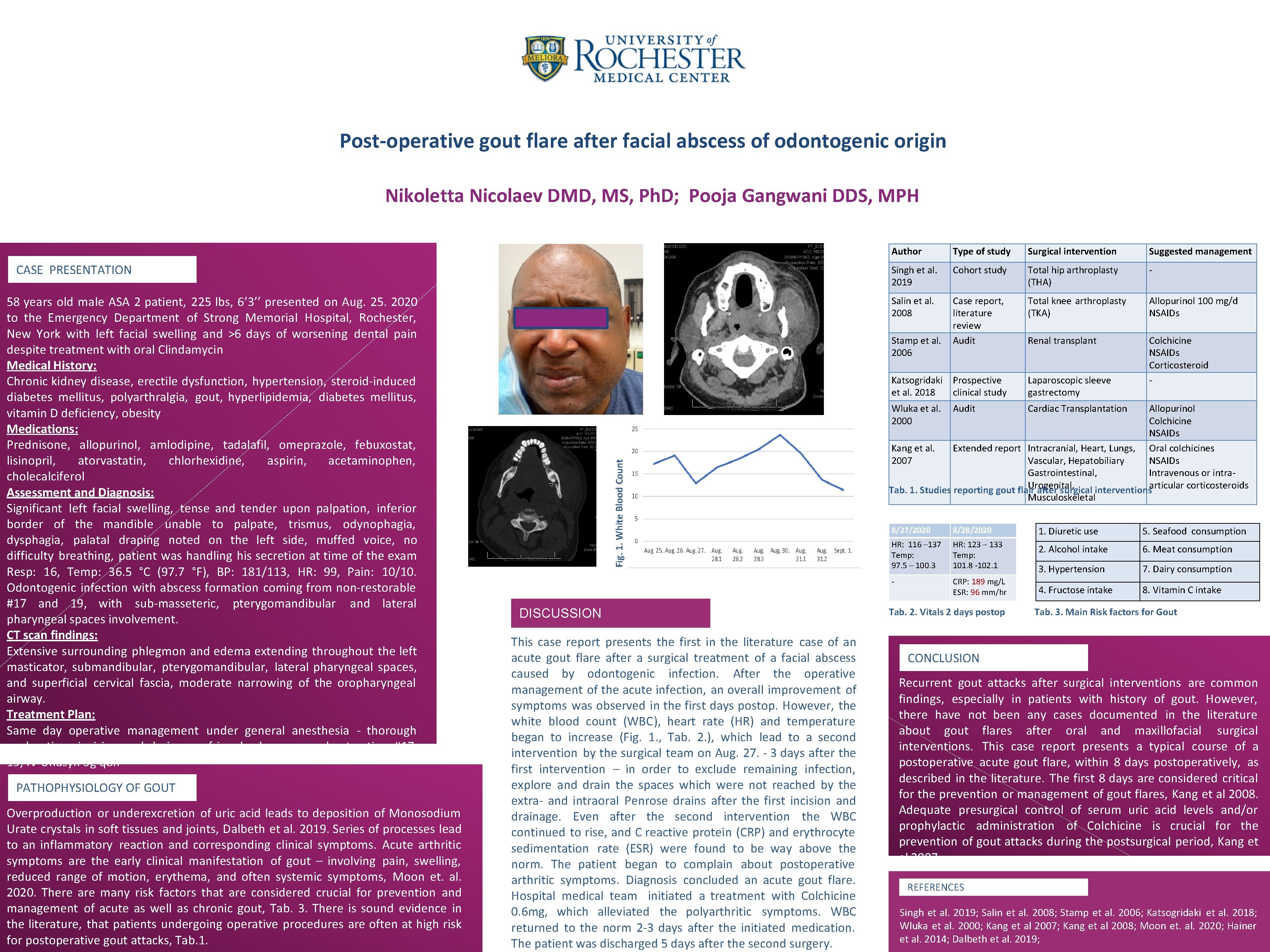 Post-operative gout flare after facial abscess of odontogenic origin Nikoletta Nicolaev DMD, MS, Ph.